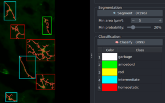 microglia analyzer